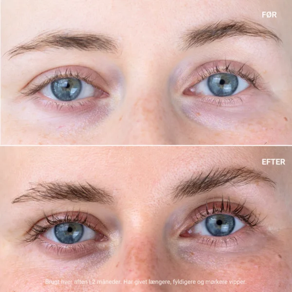 Eyelash Growth Serum - Image 2