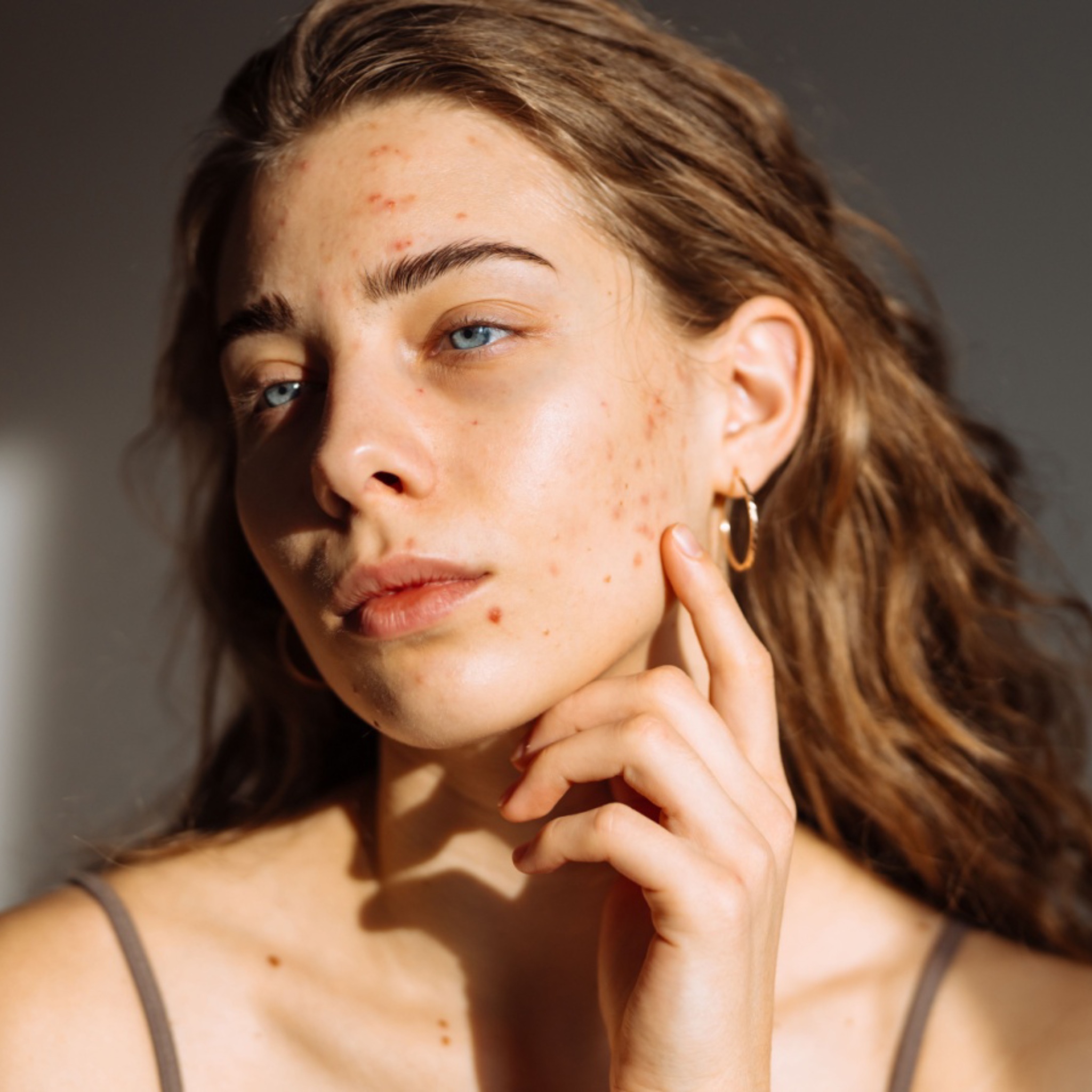 Til acne ansigtsbehandlinger